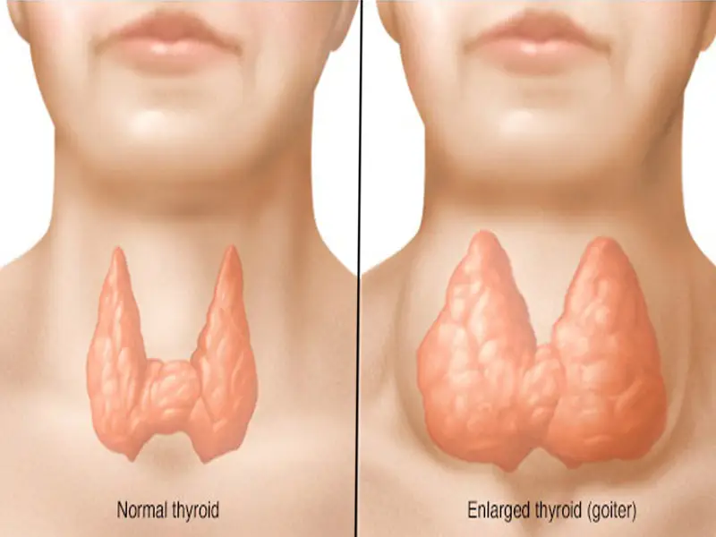 تاثیر بره موم برای سرطان