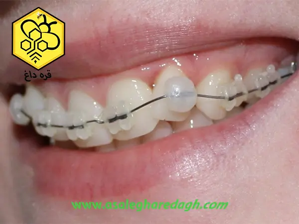 موم طبیعی رنگ زرد