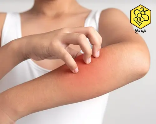 گرده گل زنبورعسل