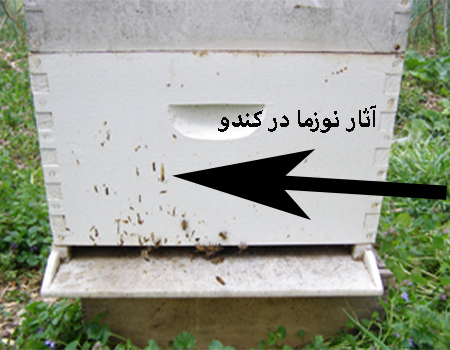 فوماژیلین داروی نوزما